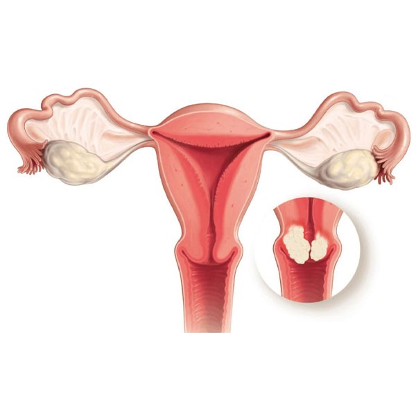 Genital Estetik, İç Dudak Estetiği, Labioplasti, Dış Dudak Estetiği, Vulvoplasti, Klitoris Estetiği, Hudoplasti, Vajinoplasti, Vajina Daraltma, Perinoplasti, Doğum İzleri Estetiği, Kızlık Zarı Onarımı, Himenorafi, Himenoplasti, Ürojinekoloji, Pelvik Taban Bozuklukları, İdrar Kaçırma, İnkontinans, Stres İnkontinans, Urge İnkontinans, Mikst İnkontinans, Sistosel, İdrar Torbası Sarkması, Rektosel, Bağırsak Fıtığı, Rahim Sarkması, Jinekoloji, Myomlar, Yumurtalık Kistleri, Endometriozis, Çikolata Kisti, Bartholin Kisti, Rahim Perdesi, Uterin Septum, Rahim İçi Polipler, Rahim Ağzı Lezyonları, Cinsel Yolla Bulaşan Hastalıklar, HPV, Genital Siğiller, Frengi, Sifiliz, Bel Soğukluğu, Gonore, Klamidya Enfeksiyonu, Trikomonas Enfeksiyonu, Mikoplazma Enfeksiyonu, Ureaplasma Enfeksiyonu, Genital Uçuk, Herpes, Yumuşak Çıban, Şankroid, Donovanoz, Granüloma İnguinale, İnfertilite, Primer İnfertilite, Sekonder İnfertilite, Açıklanamayan İnfertilite, HSG, Jinekolojik Endokrinoloji, PKOS, Adet Düzensizliği, Erken Menopoz, Sık Adet Görme, Yoğun Kanamalar, Gebelik Takibi